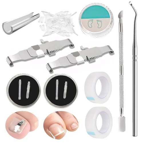 Pcs Nagelspange FußNäGel,Eingewachsene ZehennäGel Set,Zehennagel Eingewachsen,Nagelspange FußNäGel,Zehennagel Korrektur,Ingrown Toenail,Zehennagel Spange,Nagelspange 152