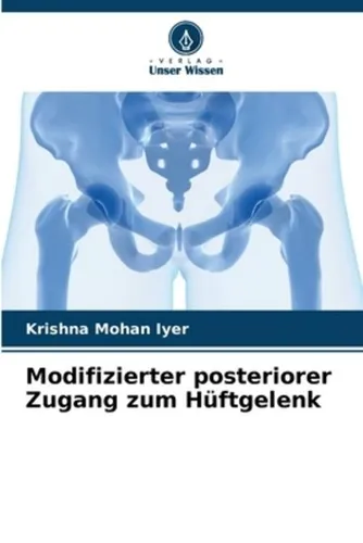 Modifizierter posteriorer Zugang zum Hüftgelenk - Fachbuch von Krishna Mohan Iyer - Fachbuch über den modifizierten posterioren Zugang zum Hüftgelenk, bietet umfassende Einblicke und praxisnahe Anleitungen für Mediziner.