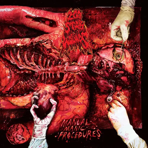STAB WOUNDS - Manual Manic Procedures - CD 200