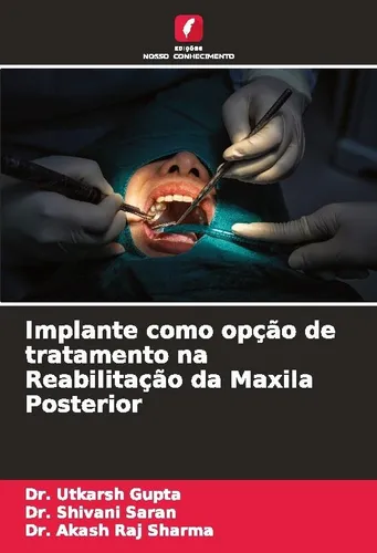 Implante como opção de tratamento na Reabilitação da Maxila Posterior Utkarsh Gu
