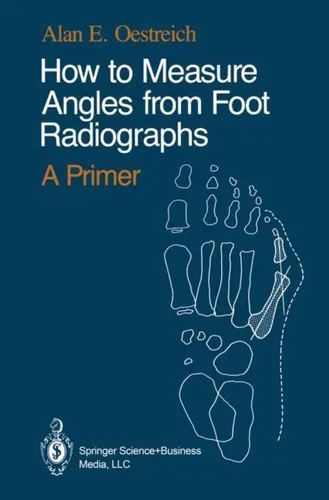 How to Measure Angles from Foot Radiographs Alan E. Oestreich