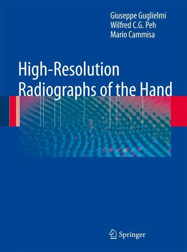 High-Resolution Radiographs of the Hand von Giuseppe Guglielmi - Fachbuch über hochauflösende Hand-Röntgenbilder, Softcover, 196 Seiten, ideal für Mediziner und Rheumatologen.