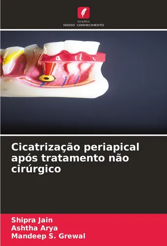 Cicatrização periapical após tratamento não cirúrgico Shipra Jain