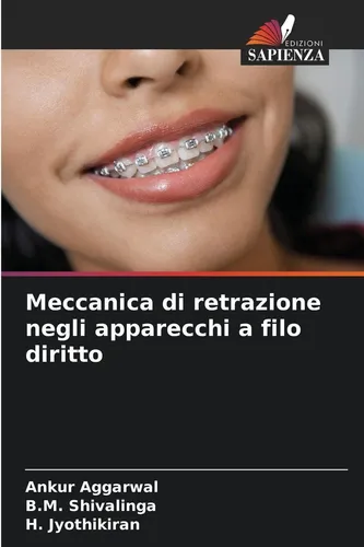 Meccanica di retrazione negli apparecchi a filo diritto Ankur Aggarwal