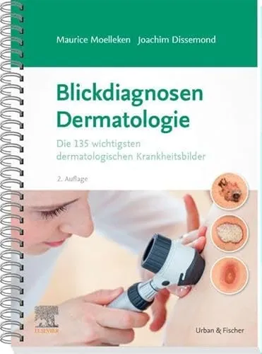 Blickdiagnosen Dermatologie: Die 135 wichtigsten dermatologischen Krankheitsbilder - Medizinstudium: Umfassendes Nachschlagewerk für angehende Ärzte mit 135 wichtigen Krankheitsbildern für die schnelle Diagnosestellung.