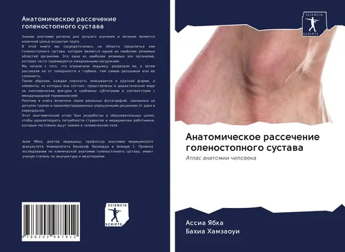 Anatomicheskoe rassechenie golenostopnogo sustawa Assia Yabka
