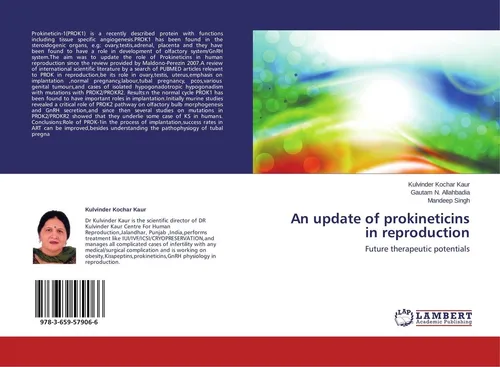 An update of prokineticins in reproduction Kulvinder Kochar Kaur