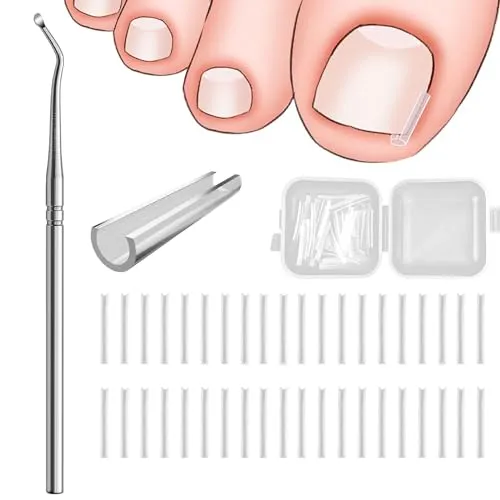 Eingewachsene Zehennägel Set - Korrektur und Pflege für gesunde Fußnägel - Praktisches Set zur Korrektur eingewachsener Zehennägel mit 40 Korrektur-Patches und einem Lifter. Bietet Unterstützung bei der Pflege und verbessert die Nagelform für ein schönes Erscheinungsbild.