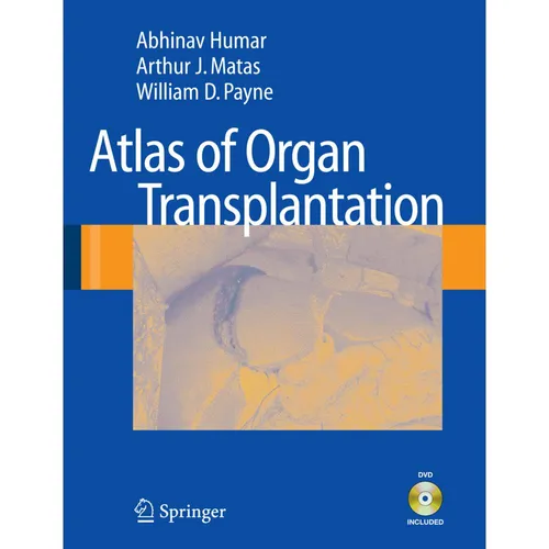 Springer Atlas of Organ Transplantation (Englisch, Abhinav Humar, Arthur J. Matas, William D. Payne, 2008) (7754918)