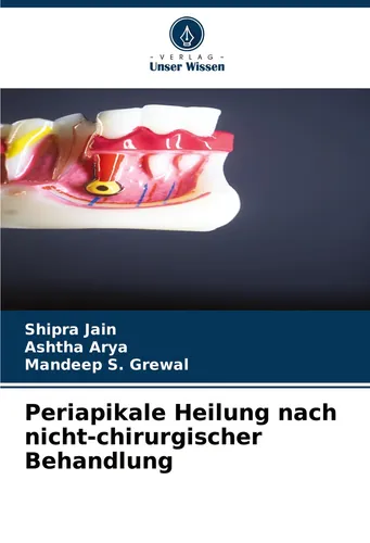 Periapikale Heilung nach nicht-chirurgischer Behandlung Shipra Jain