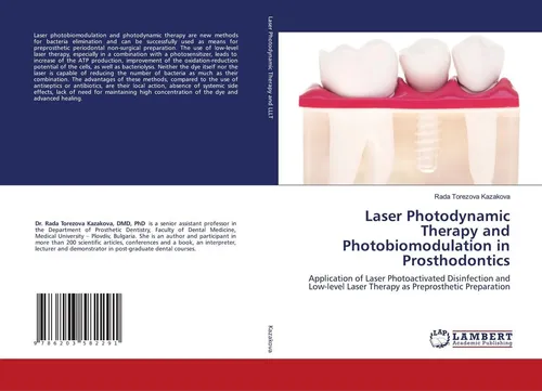 Laser Photodynamic Therapy and Photobiomodulation in Prosthodontics Rada Torezov