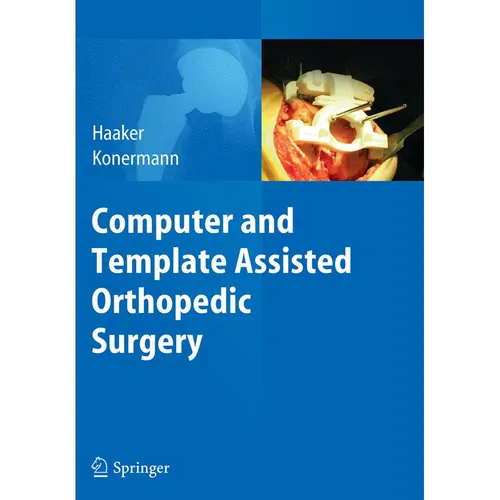 Springer Computer and Template Assisted Orthopedic Surgery (Werner Konermann, Rolf Haaker, 2016) (55833128)