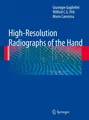 High-Resolution Radiographs of the Hand Giuseppe Guglielmi