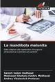 La mandibola malunita Sameh Salem Hadhoud