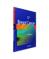 Breast Cancer: A Lobar Disease: A Lobar Disease